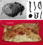 Three views of a possible medicine bundle and its contents. A black-and-white photo of the unopened cloth bundle, a black-and-white photo of five cloth strips and a clump of human hair found inside, and a color photo of the outer cloth wrapping of the bundle.