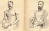 Blaikie's illustration of the half-built athlete. William Blaikie, How to Get Strong and How to Stay So (New York: Harper & Brothers, 1879), 36.