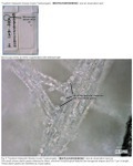 This upper photo shows an original material, and the lower photo shows starch grains (Oryza sativa) entwined to fibers.