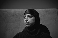 Black and white photo of an Iraqi woman with hair covered and scars on her face. She is looking up.