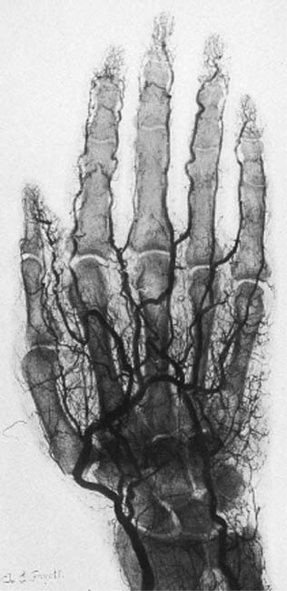 In the 1890s the X-ray or Roentgen ray became a metaphor not only for science triumphant but also for the possible reality of an unseen spiritual dimension.